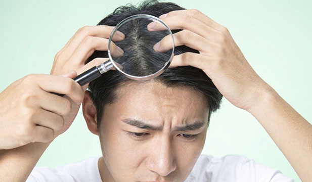 用放大镜观察头发的图片